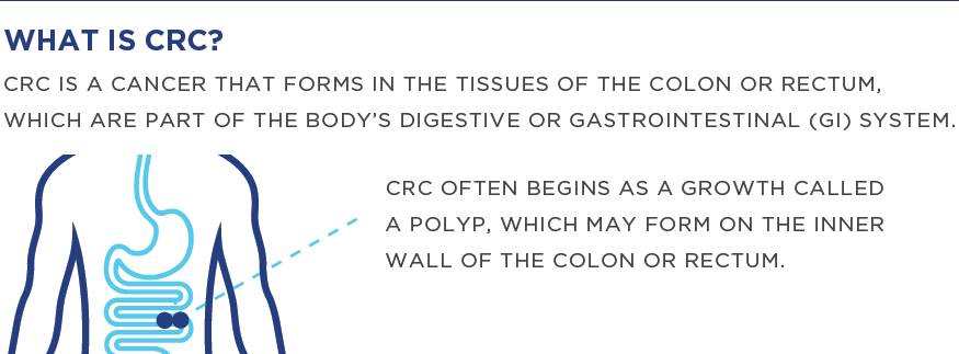 Infographic explaining what Colorectal Cancer is and whereit forms in the body