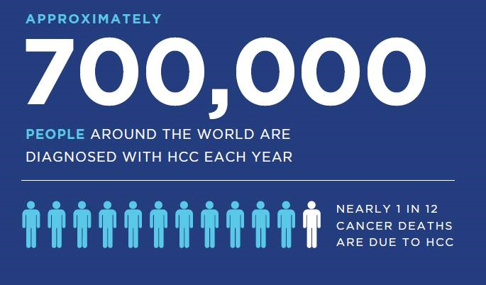Infographic illustrating the incidence of HCC, symbolizing the need for increased awareness and education about this type of cancer